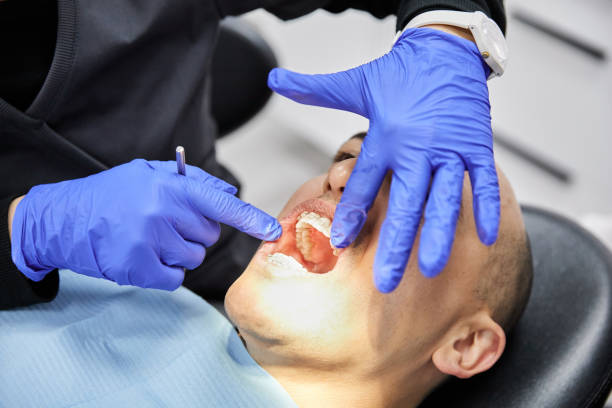 Best Knocked-Out Tooth (Avulsed Tooth) Treatment in Cookeville, TN